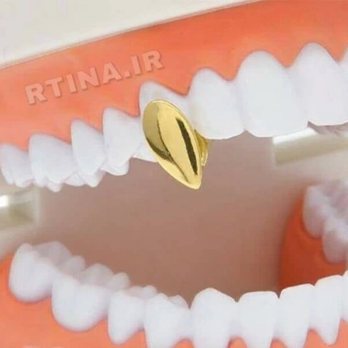 تصویر روکش تزئینی تک دندان مدل Vampire 