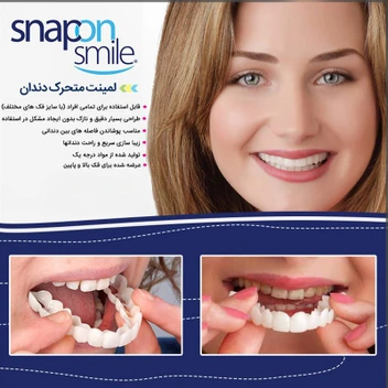 تصویر لمینت دندان مدل snap on smile 