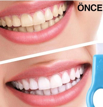 تصویر ژل سفیدکننده دندان فوری Mbois کد:Giderici 2162749 